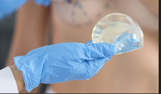 Retiro de protesis mamaria