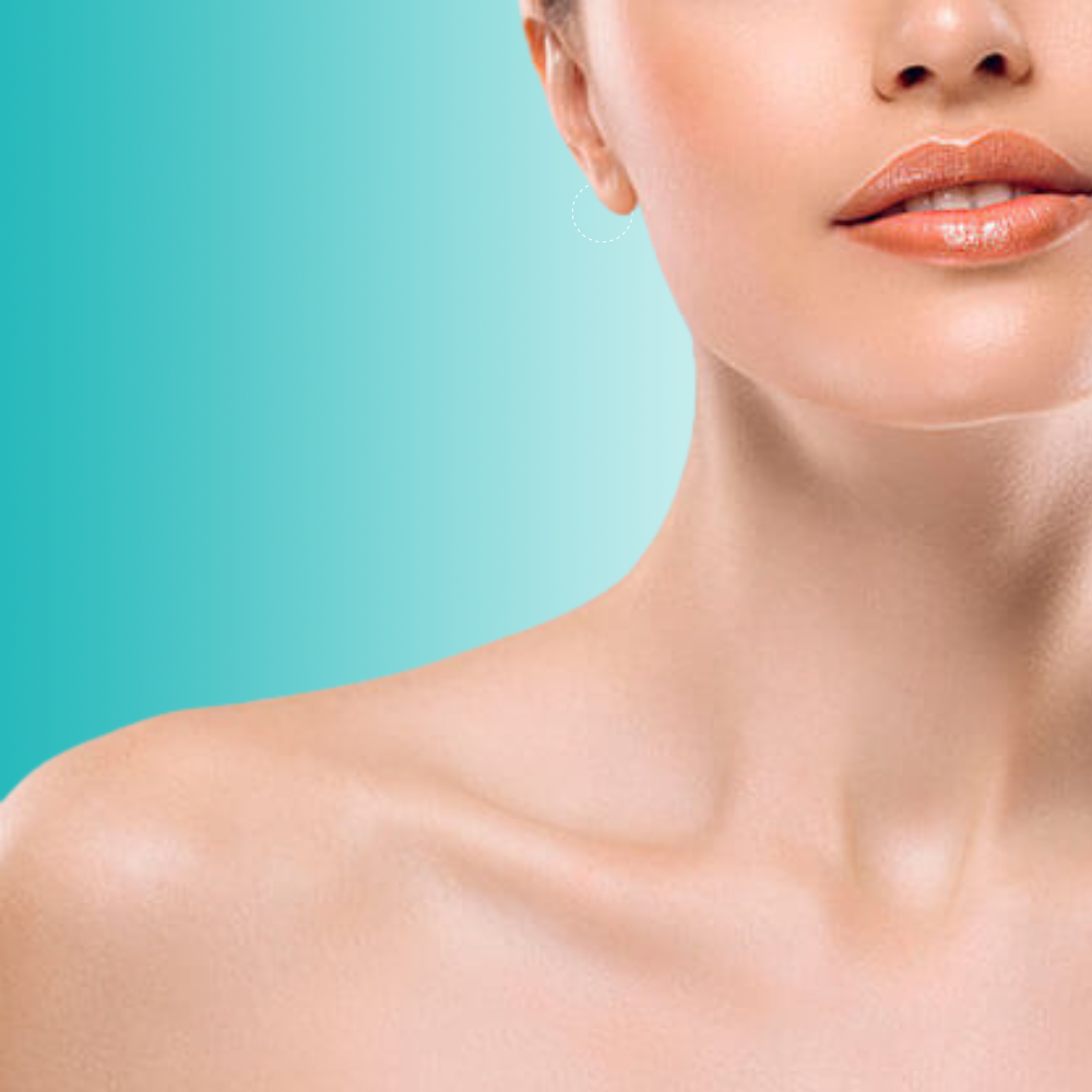 Fotorejuvenecimiento Escote