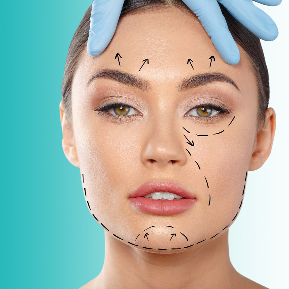 Relleno Ácido Hialurónico (Art filler)