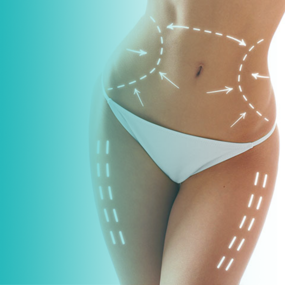 Remodelación Corporal