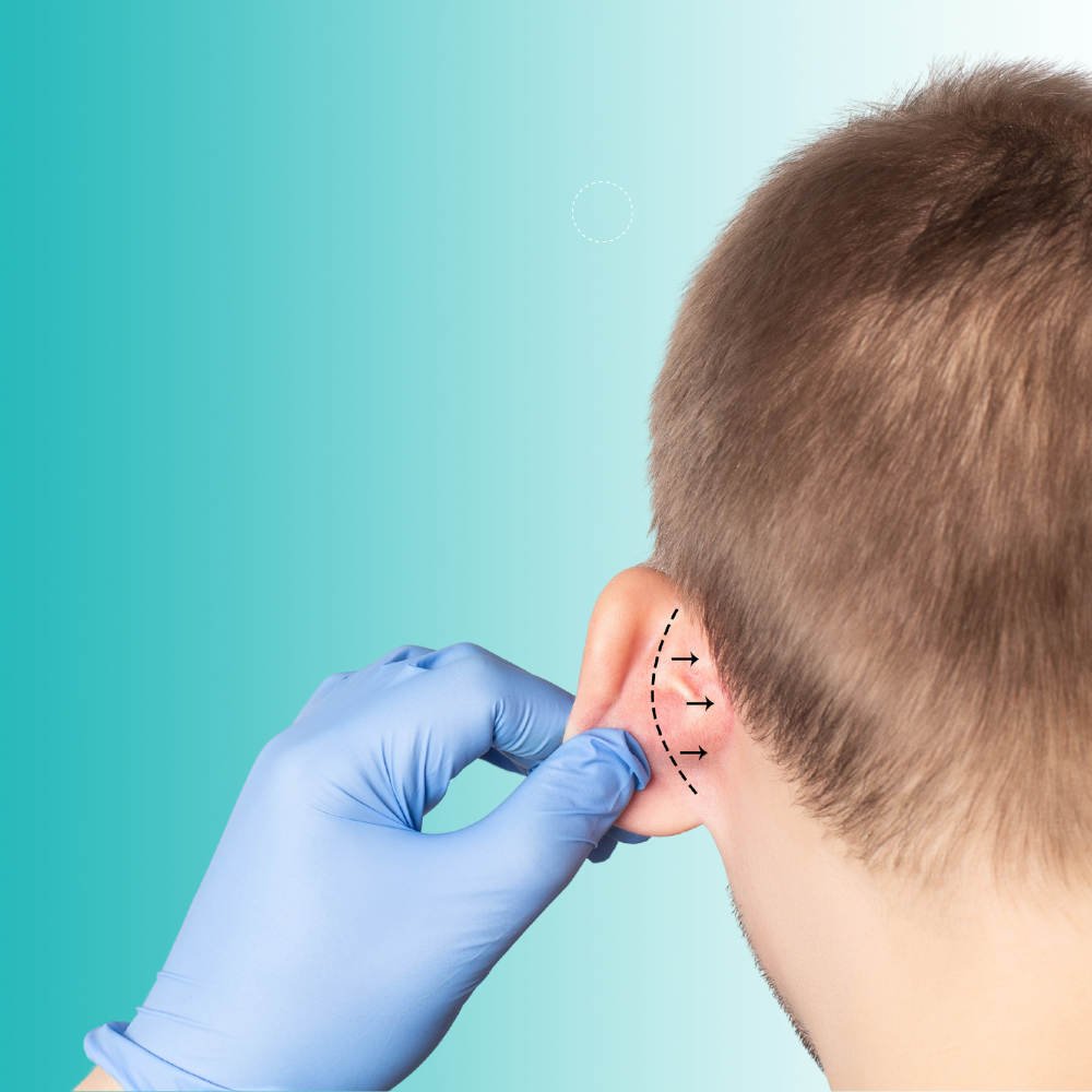 Malformaciones de orejas