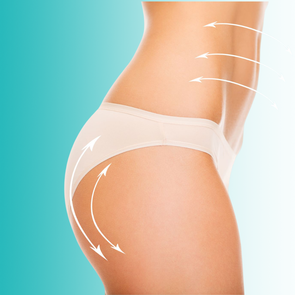 Lipotransferencia glútea