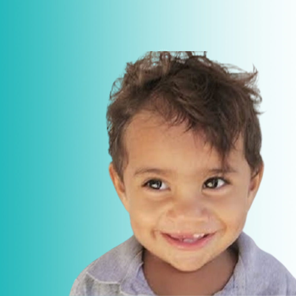 Reconstrucción de labios