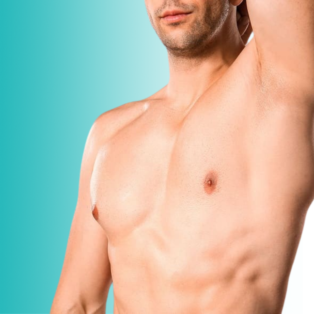 Ginecomastia